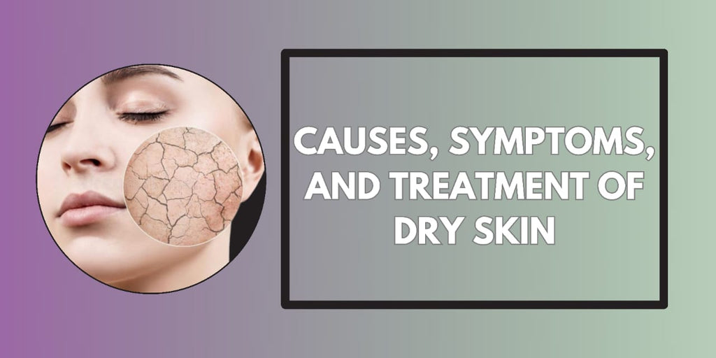 Dry Skin: Causes, Symptoms, Treatment