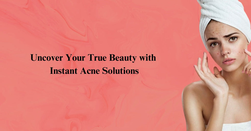 Acne Ka Fori Ilaj: Instant Solutions For Clear Skin